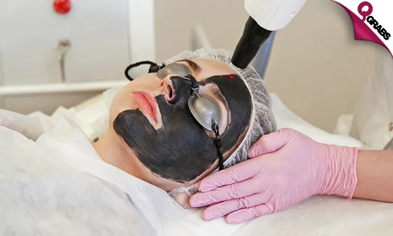 Carbon Laser Facial Treatment + Consultation!